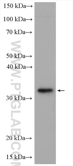 C21orf2 Rabbit anti-Human, Polyclonal, Proteintech 150 &mu;L; Unconjugated:Antibodies,