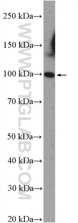 FBXO11 Rabbit anti-Human, Polyclonal, Proteintech:Antibodies:Primary Antibodies