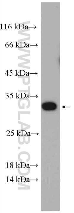DBNDD2 Rabbit anti-Human, Mouse, Rat, Polyclonal, Proteintech 150 &mu;L | Buy Online | Proteintech | Fisher Scientific