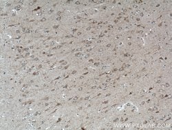 WDR8 Rabbit anti-Human, Polyclonal, Proteintech 20 &mu;L; Unconjugated:Antibodies,