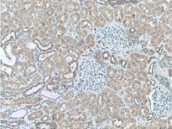 GSDMC Rabbit anti-Human, Mouse, Polyclonal, Proteintech 20 &mu;L; Unconjugated:Antibodies,