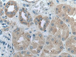 GSDMC Rabbit anti-Human, Mouse, Polyclonal, Proteintech 20 &mu;L; Unconjugated:Antibodies,