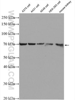 GSDMC Rabbit anti-Human, Mouse, Polyclonal, Proteintech 20 &mu;L; Unconjugated:Antibodies,