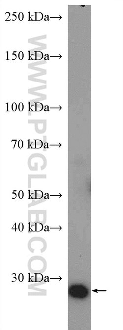 KDELR3 Rabbit anti-Human, Mouse, Polyclonal, Proteintech:Antibodies:Primary