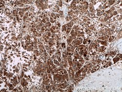 PIP5K1C Rabbit anti-Human, Polyclonal, Proteintech 150 &mu;L; Unconjugated:Antibodies,