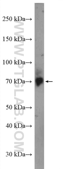 PIP5K1C Rabbit anti-Human, Polyclonal, Proteintech 150 &mu;L; Unconjugated:Antibodies,