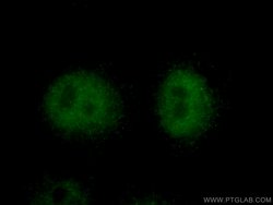 TXNL4A Rabbit anti-Human, Polyclonal, Proteintech 150 &mu;L; Unconjugated:Antibodies,