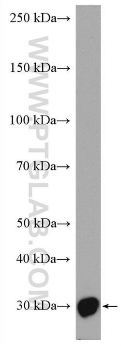 SAP30 Rabbit anti-Human, Polyclonal, Proteintech 150 &mu;L | Buy Online | Proteintech Group Inc | Fisher Scientific
