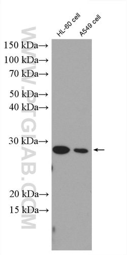 SAP30 Rabbit anti-Human, Polyclonal, Proteintech 150 &mu;L | Buy Online | Proteintech Group Inc | Fisher Scientific