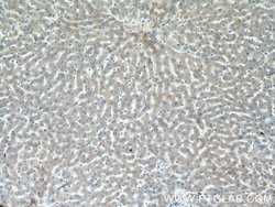 ABCG5 Rabbit anti-Human, Mouse, Rat, Polyclonal, Proteintech:Antibodies:Primary