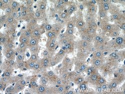 ABCG5 Rabbit anti-Human, Mouse, Rat, Polyclonal, Proteintech:Antibodies:Primary
