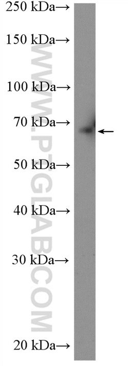 ABCG5 Rabbit anti-Human, Mouse, Rat, Polyclonal, Proteintech:Antibodies:Primary