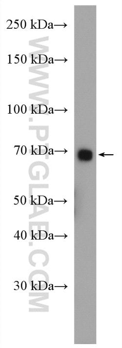 ABCG5 Rabbit anti-Human, Mouse, Rat, Polyclonal, Proteintech:Antibodies:Primary