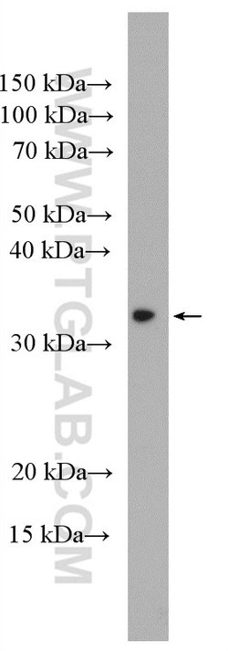ECHDC1 Rabbit anti-Human, Mouse, Rat, Polyclonal, Proteintech:Antibodies:Primary