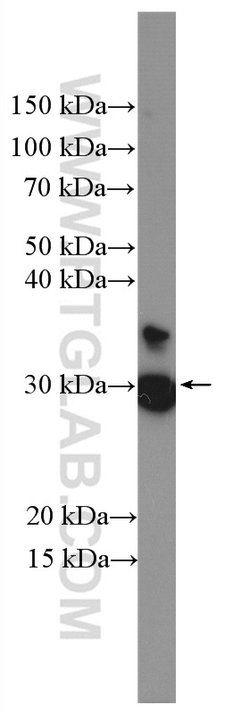 ECHDC1 Rabbit anti-Human, Mouse, Rat, Polyclonal, Proteintech:Antibodies:Primary