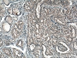 SLC24A5 Rabbit anti-Human, Mouse, Rat, Polyclonal, Proteintech 20 &mu;L;