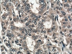 SLC24A5 Rabbit anti-Human, Mouse, Rat, Polyclonal, Proteintech 20 &mu;L;