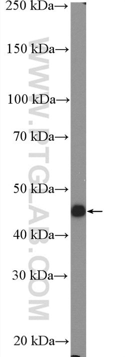 SLC24A5 Rabbit anti-Human, Mouse, Rat, Polyclonal, Proteintech 20 &mu;L;