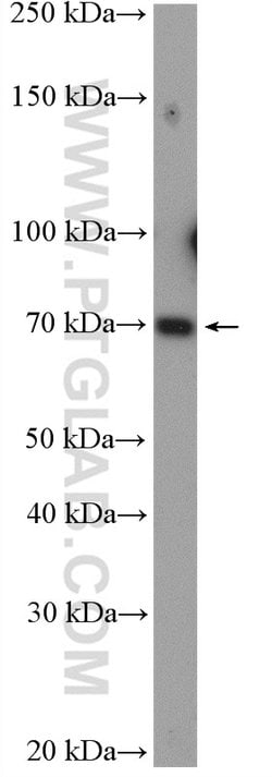 TGM7 Rabbit anti-Human, Mouse, Rat, Polyclonal, Proteintech 20 &mu;L; Unconjugated:Antibodies,