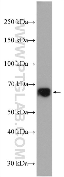 C17orf80 Rabbit anti-Human, Polyclonal, Proteintech 150 &mu;L | Buy Online | Proteintech Group Inc | Fisher Scientific