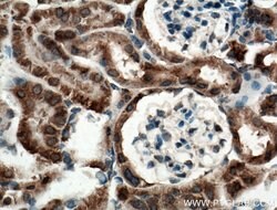ANK3 Rabbit anti-Human, Polyclonal, Proteintech 150 &mu;L; Unconjugated:Antibodies,