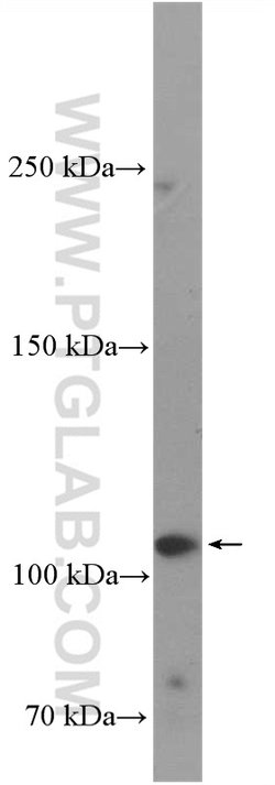 ANK3 Rabbit anti-Human, Polyclonal, Proteintech 150 &mu;L; Unconjugated:Antibodies,