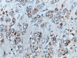 ETHE1 Rabbit anti-Human, Polyclonal, Proteintech:Antibodies:Primary Antibodies