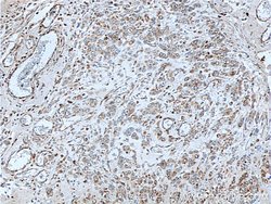 ETHE1 Rabbit anti-Human, Polyclonal, Proteintech:Antibodies:Primary Antibodies