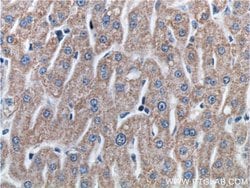 ETHE1 Rabbit anti-Human, Polyclonal, Proteintech:Antibodies:Primary Antibodies