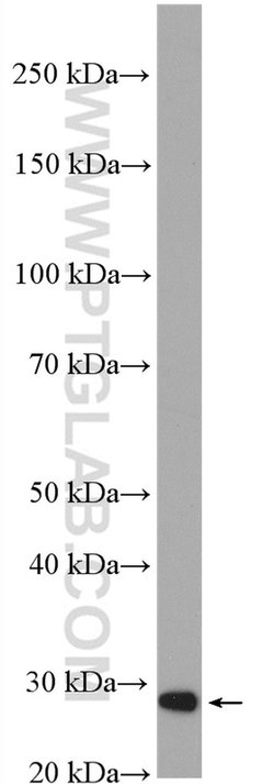 ETHE1 Rabbit anti-Human, Polyclonal, Proteintech:Antibodies:Primary Antibodies