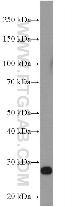 RanBP1 Rabbit anti-Human, Mouse, Polyclonal, Proteintech:Antibodies:Primary
