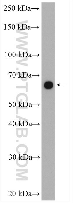 ZNF570 Rabbit anti-Human, Polyclonal, Proteintech 20 &mu;L; Unconjugated:Antibodies,