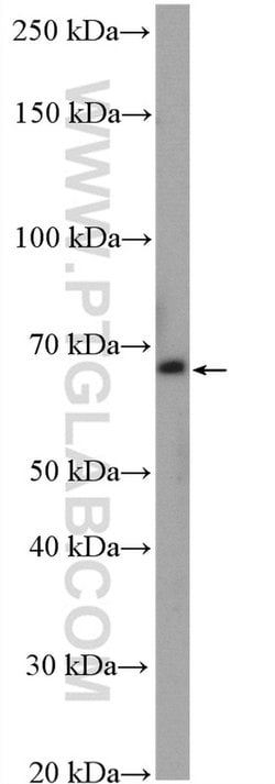 ZNF570 Rabbit anti-Human, Polyclonal, Proteintech 20 &mu;L; Unconjugated:Antibodies,
