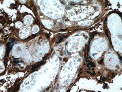 HSD17B1 Rabbit anti-Human, Polyclonal, Proteintech 150 &mu;L; Unconjugated:Antibodies,