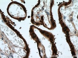 HSD17B1 Rabbit anti-Human, Polyclonal, Proteintech 150 &mu;L; Unconjugated:Antibodies,