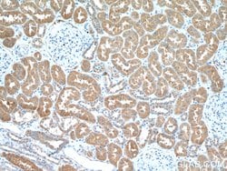 HSD17B1 Rabbit anti-Human, Polyclonal, Proteintech 150 &mu;L; Unconjugated:Antibodies,