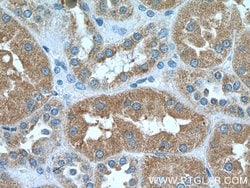 HSD17B1 Rabbit anti-Human, Polyclonal, Proteintech 150 &mu;L; Unconjugated:Antibodies,