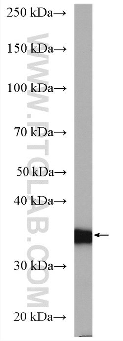 HSD17B1 Rabbit anti-Human, Polyclonal, Proteintech 150 &mu;L; Unconjugated:Antibodies,