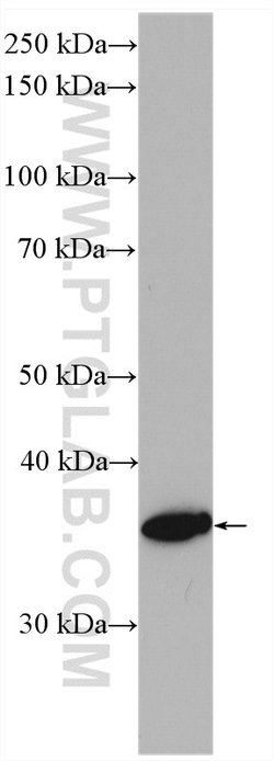HSD17B1 Rabbit anti-Human, Polyclonal, Proteintech 150 &mu;L; Unconjugated:Antibodies,