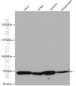 MTSS1L Rabbit anti-Human, Mouse, Polyclonal, Proteintech 150 &mu;L; Unconjugated:Antibodies,