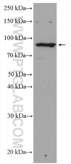 RASA2/3 Rabbit anti-Human, Mouse, Polyclonal, Proteintech 150 &mu;L | Buy Online | Proteintech Group Inc | Fisher Scientific