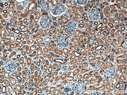 C22orf25 Rabbit anti-Human, Mouse, Polyclonal, Proteintech:Antibodies:Primary