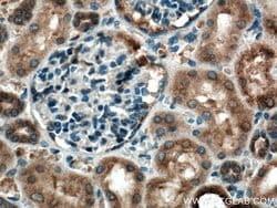C22orf25 Rabbit anti-Human, Mouse, Polyclonal, Proteintech:Antibodies:Primary