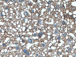 ABCC6 Rabbit anti-Human, Mouse, Polyclonal, Proteintech 150 &mu;L | Buy Online | Proteintech Group Inc | Fisher Scientific