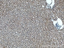 ABCC6 Rabbit anti-Human, Mouse, Polyclonal, Proteintech 150 &mu;L | Buy Online | Proteintech Group Inc | Fisher Scientific