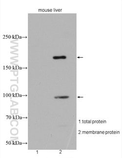 ABCC6 Rabbit anti-Human, Mouse, Polyclonal, Proteintech 150 &mu;L | Buy Online | Proteintech Group Inc | Fisher Scientific