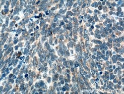 SLC25A46 Rabbit anti-Human, Mouse, Polyclonal, Proteintech 20 &mu;L; Unconjugated:Antibodies,