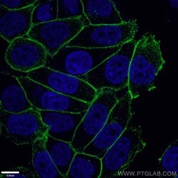 gamma catenin Rabbit anti-Human, Polyclonal, Proteintech 150 &mu;L; Unconjugated:Anticuerpos