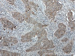 gamma catenin Rabbit anti-Human, Polyclonal, Proteintech 150 &mu;L; Unconjugated:Anticuerpos