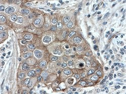 gamma catenin Rabbit anti-Human, Polyclonal, Proteintech 150 &mu;L; Unconjugated:Anticuerpos